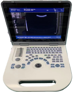 Vente chaude Médical B/W Ultrason <span class=keywords><strong>S50A</strong></span> Ultrason 2D Cahier de Grossesse Gynécologique USG Machine à Ultrasons - Product Image 1