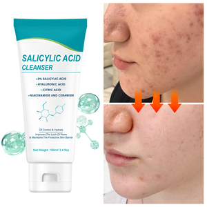 Limpiador facial antigrasoso y antiespinillas de ácido salicílico, limpiador facial espumoso de niacinamida de limpieza suave e iluminador - Product Image 4