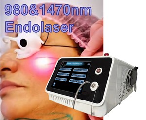 Appareil de <span class=keywords><strong>lipolyse</strong></span> laser Endolaser 1470nm 980 pour la dissolvation des graisses en chirurgie plastique, élimination du <span class=keywords><strong>double</strong></span> <span class=keywords><strong>menton</strong></span>, liposuccion corporelle et lifting facial - Product Image 1
