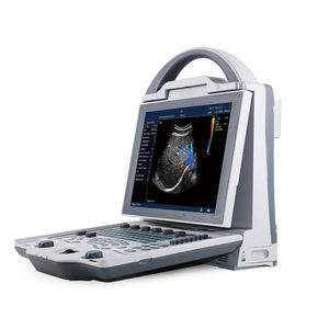 YSB-DU12V Geysendeerde Draagbare Veterinaire Echografie Kleur <span class=keywords><strong>Doppler</strong></span> Echografie Machine Dierenarts <span class=keywords><strong>3d</strong></span> 4d Gekleurde Veterinaire Echografie - Product Image 4