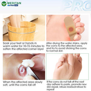 Plester Penghilang Kapalan Kaki Clavus dengan Asam Salisilat Bersertifikat CE untuk Kapalan Jari Kaki 6-Pak Plester Pereda Nyeri Meditan - Product Image 3