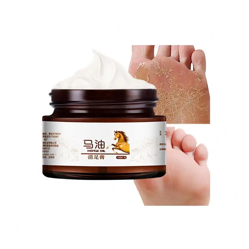 Fuß aufhellung ohne Marke Undecylen säure 40% Private Label Fußpflege USA vegane Vitamin E Harnstoff creme für rissige Füße