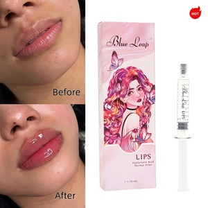 Bestseller : Remplisseurs dermiques pour les lèvres 10 ml pour l'amélioration des lèvres, l'amélioration de la commissure glabélaire et des rides modérées – Qualité garantie - Product Image 1