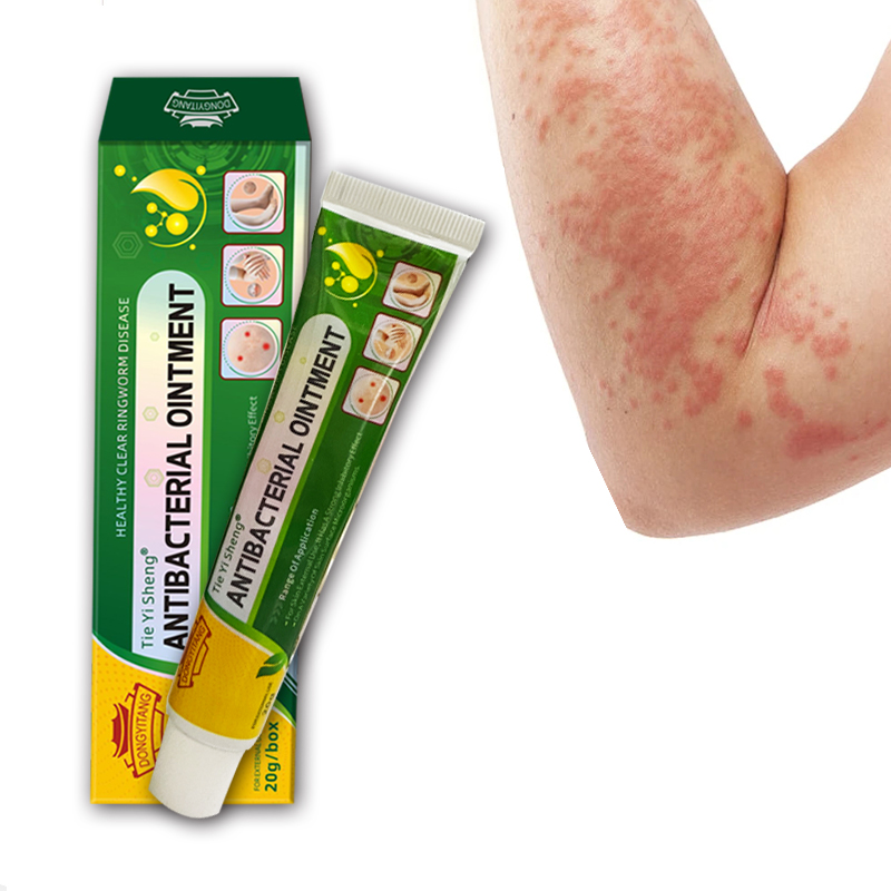 Factory Supply Herbal Formula Skin Care Ointment Ringworm Itching Cream