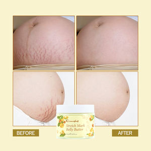 Neue Stretch Mark Bauch butter creme Shea butter Vitamin <span class=keywords><strong>E</strong></span> Kokosöl Feuchtigkeit Verbessern Sie die Haute lastizität Produkt für Dehnung streifen - Product Image 6