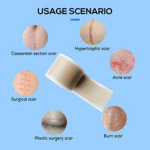 Y tế cấp Silicone gel mặc quần áo loại bỏ vết sẹo vá tự dính sẹo sửa chữa Băng vá - Product Image 2