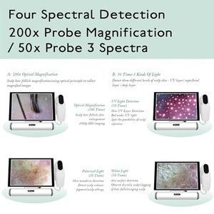 Professional 11 Inch Scalp Camera Hair and Scalp Analysis Device50/200x Lens Ideal for Client Consultations & Head Spa - Product Image 6