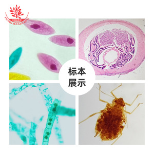 Lames microscopiques, spécimens végétaux et animaux clairs et minuscules, ensemble de 5 lames pour l'exploration précoce des enfants et la microscopie - Product Image 1