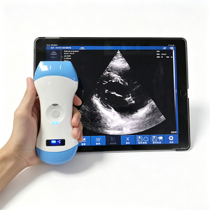Escáner de Ultrasonido Inalámbrico Portátil Sin Cables para Servicio de Clínica Móvil, Descarga y Almacenamiento de Informes de Exámenes de Pacientes - Product Image 6
