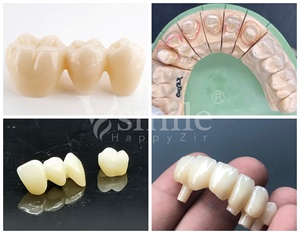 Matériaux dentaires en zircone <span class=keywords><strong>Vsmile</strong></span>, blocs et disques en céramique de zircone multicouche SHT de 98 mm pour CAD dentaire, implant dentaire All-on-X - Product Image 5