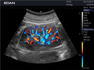 Échographe Doppler Couleur à Double Écran Haute Définition sur Chariot Edan LX3 avec Batterie Intégrée pour Hôpitaux et Soins Médicaux - Product Image 6