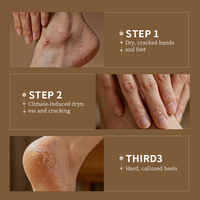 Crème anti-fissures pour les mains et les pieds au beurre de karité, hydratante et réparatrice pour peaux sèches et gercées, soin adoucissant pour les pieds, vente en gros 60g pour adultes
