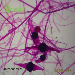 Rhizopus W.M. bacteriology microbiology prepared glass microscope slides