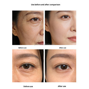 Fábrica OEM: Lifting Facial Instantáneo <span class=keywords><strong>V</strong></span>-<span class=keywords><strong>Line</strong></span> para Piel Flácida, Elimina la Papada y Reduce la Hinchazón Facial, Reafirmante <span class=keywords><strong>V</strong></span>-<span class=keywords><strong>Line</strong></span> - Product Image 5