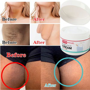 FATAZEN OEM ODM отбеливающий крем для подмышек на коленях алоэ вера арбутин против темных пятен увлажняющий отбеливающий крем для тела сияние - Product Image 6