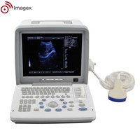 Équipement portatif portatif de sonographie d'ultrason de Full Digital avec des options multiples de sonde pour la pratique générale