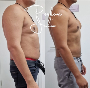 جهاز فيزر لشفط الدهون 980 نانومتر 1470 نانومتر جهاز ليزر ليبوليسيس رفع داخلي - Product Image 5