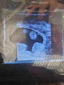 Détecteur de grossesse de truie de chèvre de mouton vétérinaire portable Machine à ultrasons de grossesse de chèvre - Product Image 2