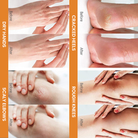 Crème pour les pieds à 2% d'acide salicylique et 40% d'urée pour éliminer les callosités et les peaux mortes, soin des pieds, exfoliation, élimination des peaux mortes, pour les talons gercés