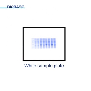 Sistema de Imagenología y Análisis de <span class=keywords><strong>Gel</strong></span> Automático BIOBASE BK-AG100, Alta Sensibilidad, Alta Resolución, con Enfoque Automático - Product Image 5
