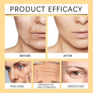 2025 vente directe d'usine venin d'abeille naturel ingrédient raffermissant les rides crème crème pour le visage légère - Product Image 2