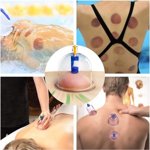 Juego de Herramientas de Masaje Gua Sha Eléctricas Inteligentes, Masajeador de Ventosas al Vacío, 4 Ventosas - Product Image 6