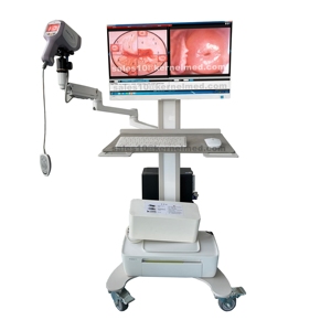 Hạt Nhân KN-2200I Xe đẩy loại 1080p HD <span class=keywords><strong>video</strong></span> kỹ thuật số soi cổ tử cung cho phụ khoa âm đạo kiểm tra - Product Image 1