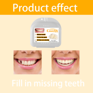 Vương miện siêu mỏng răng vá nhựa tạm thời răng cho răng trước veneers provisionals trước trên tạm thời vương miện răng - Product Image 5