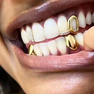 Grillz en or fin, design géométrique, sertissage en canal, unisexe, pour usage quotidien - Product Image 1