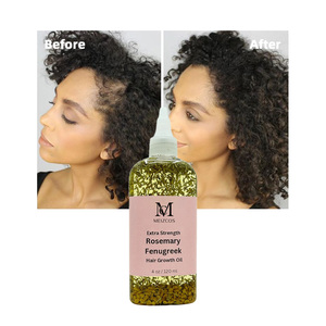 Olio per il Cuoio Capelluto OEM ODM Etichetta Privata all'Ingrosso 100% Puro Naturale Biologico con <span class=keywords><strong>Amla</strong></span>, Ricino, Fieno Greco, Rosmarino e Menta per la Crescita dei <span class=keywords><strong>Capelli</strong></span> - Product Image 1