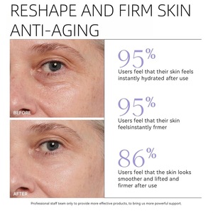 <span class=keywords><strong>Crema</strong></span> Contorno Occhi Anti-Età con Collagene Vegano, Retinolo e Nicotinamide per Ridurre la Melanina, Produzione e Vendita all'Ingrosso con Etichetta Privata - Product Image 6