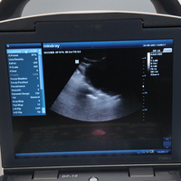 Dispositivo Médico Veterinario, Máquina de Ultrasonido Portátil de 12 Pulgadas Panel de Control Fácil de Usar para Monitor LED, Gran Venta