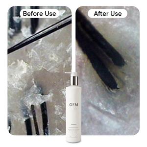 Champú para <span class=keywords><strong>el</strong></span> cabello con grasa de 300Ml para <span class=keywords><strong>cuero</strong></span> <span class=keywords><strong>cabelludo</strong></span> graso Etiqueta privada Champú purificante de 300Ml para reducir <span class=keywords><strong>el</strong></span> exceso de aceite <span class=keywords><strong>en</strong></span> <span class=keywords><strong>el</strong></span> <span class=keywords><strong>cuero</strong></span> <span class=keywords><strong>cabelludo</strong></span> - Product Image 3