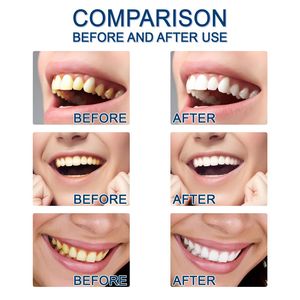 JAYSUING Cosmétique <span class=keywords><strong>Naturel</strong></span> <span class=keywords><strong>Couvre</strong></span>-dents Sans Fil Nettoyant Taches Jaunes et Tartre Haleine Fraîche Extrait Végétal Essence Blanchissante pour les Dents - Product Image 3
