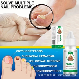 SUAI Venta al por mayor Cuidado de las uñas Engrosamiento de uñas brillante Tratamiento fúngico Reparación de uñas grises Líquido antibacteriano - Product Image 2