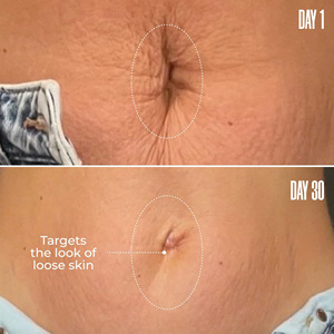 Nhãn hiệu riêng bụng friming Kem Brazil peppertree Kem lâm sàng đã được chứng minh mất dần vết rạn da mượt mà bụng Kem - Product Image 4