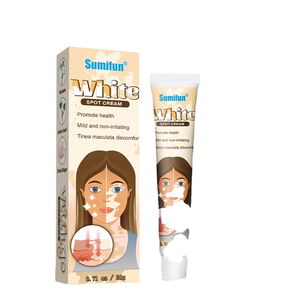 Sumifun White Vitiligo Treatment Improve Skin White Spot Relief Ointment