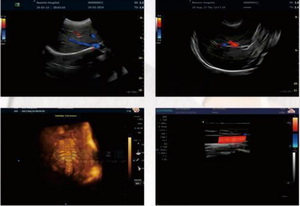 Ecógrafo Doppler Color Portátil GCT-76S, Escáner Médico Hospitalario para Exámenes de Abdomen, Obstetricia/Ginecología, Cardiología y Vascular - Product Image 4