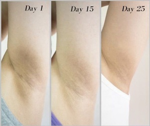 निजी लेबल अंतरंग त्वचा Whitening जेल चमकती शरीर ब्लीच क्रीम, योनि/गुदा के लिए विरंजन-सुरक्षित अंतरंग - Product Image 2