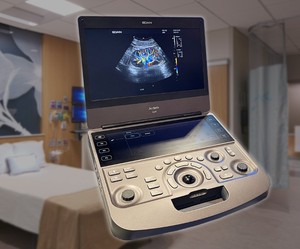 Ecógrafo Veterinario EDAN ACCLARIX AX9, Ecógrafo de Diagnóstico Portátil para Veterinarios en Venta - Product Image 2