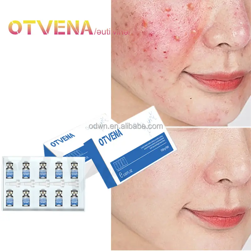 Lyophilized Powder Deep Repair Prevent Pigmentation Whitening Skin 100mg +10ml Oem Odm Lyophilized Powder