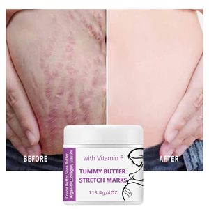Choix OEM ODM pour les femmes enceintes : Série d'huiles essentielles et d'émulsions aqueuses pour massage, crème apaisante prénatale pour le corps - Product Image 6