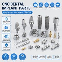 Service de fraisage CNC OEM, usinage, dessin technique, pièces métalliques personnalisées, acier inoxydable, usine de précision Meijie MJ-CNC-316