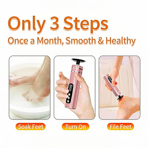 Removedor de Callos Eléctrico 6 en 1: Máquina de Pedicura con Discos de Lijado y Exfoliante para Pies para Talones Agrietados - Product Image 4