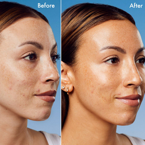 Personnalisation de Toner facial de bronzage sain naturel eau de bronzage hydratante sans contact avec le soleil bronzage sain - Product Image 5