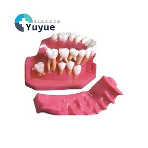 Modelo Anatómico de Desarrollo Dental - Modelo de Dentición Pediátrica Extraíble para Educación Dental - Product Image 1