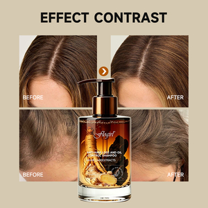 OEM ODM Anti-Oily Scalp Anti Hair Fall <strong>Shampoo</strong> Ginseng Extract Hair Growth Treatment <strong>Shampoo</strong> for Men <strong>Women</strong> - Product Image 6