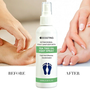 Spray Desodorante para Pies con Aceite de Árbol de Té, 100 ml, Hidratante Natural para Talones Agrietados, Control de Olores, con Logotipo Personalizado - Product Image 2