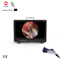 Unité d'endoscopie ORL portable tout-en-un IKEDA YKD-9122 à alimentation électrique avec écran et système de caméra 1080P pour sinusoïdoscopie et laryngoscopie