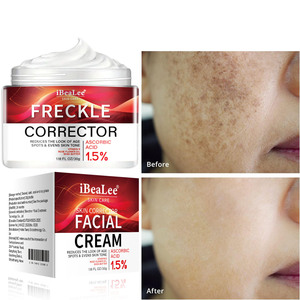 Crema Blanqueadora para Pecas, Eliminador de <span class=keywords><strong>Manchas</strong></span> Oscuras y Melasma, Anti-<span class=keywords><strong>Manchas</strong></span> Marrones, Aclara la Pigmentación, Hidratante, Cuidado de la Piel, Productos Coreanos - Product Image 2